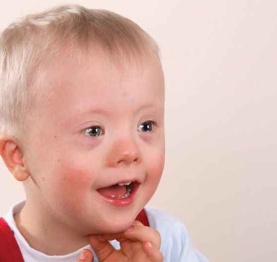 Олигофрения в Северодвинске
